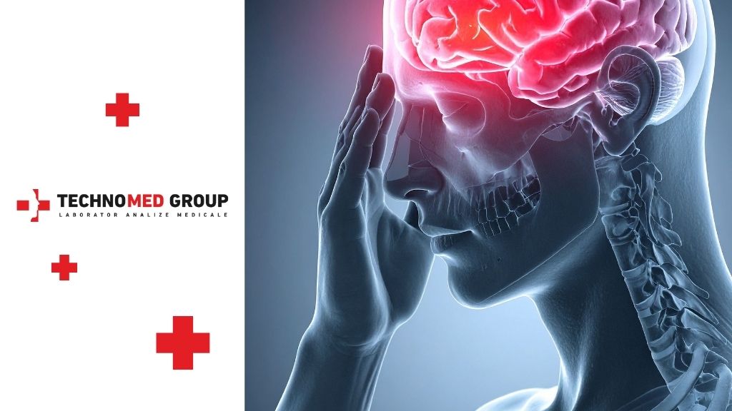 pacienții cu boli cerebrovasculare